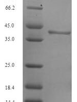 Arabidopsis thaliana Sucrose-phosphate synthase 1 (SPS1), partial Recombinant Protein - BioCrest Sci