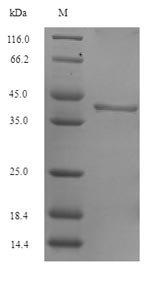 Arabidopsis thaliana Sucrose-phosphate synthase 1 (SPS1), partial Recombinant Protein, Arabidopsis thaliana (Mouse-ear cress), E.coli, N-terminal 6xHis-SUMO-tagged, 41.5 kDa, purity >≥ 90% as determined by SDS-PAGE.