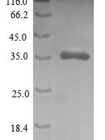Human Cysteine-rich protein 1 (CRIP1), partial Recombinant Protein - BioCrest Sci
