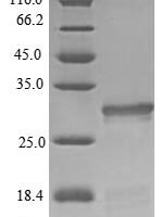 Pig Somatotropin (GH1) Recombinant Protein - BioCrest Sci