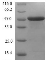 Human Centrin-1 (CETN1) Recombinant Protein - BioCrest Sci