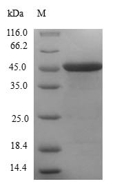 Human Centrin-1 (CETN1) Recombinant Protein, Homo sapiens (Human), E.coli, N-terminal GST-tagged, 46.6 kDa, purity >≥ 90% as determined by SDS-PAGE.