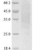 Phleum pratense Pollen allergen Phl p 1 (PHLPI) Recombinant Protein, N-His-SUMOstar - BioCrest Sci