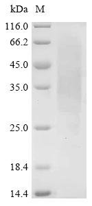 Phleum pratense Pollen allergen Phl p 1 (PHLPI) Recombinant Protein, N-His-SUMOstar, Phleum pratense (Common timothy), Yeast, N-terminal 6xHis-sumostar-tagged, 39.2 kDa, purity >≥ 90% as determined by SDS-PAGE.