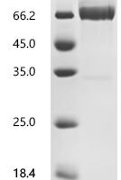 Mouse Interleukin-2 receptor subunit alpha (Il2ra), partial Recombinant Protein - BioCrest Sci