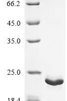 Locusta migratoria OBP10 protein (OBP10) (I18L,V57I,N131Q) Recombinant Protein - BioCrest Sci
