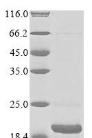 Macaca fascicularis Parathyroid hormone (PTH) Recombinant Protein, N-10His/C-Myc - BioCrest Sci