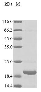 Macaca fascicularis Parathyroid hormone (PTH) Recombinant Protein, N-10His/C-Myc, Macaca fascicularis (Crab-eating macaque) (Cynomolgus monkey), E.coli, N-terminal 10xHis-tagged and C-terminal Myc-tagged, 16.9 kDa, purity >≥ 85% as determined by SDS-PAGE.
