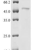Stenotrophomonas maltophilia Dicamba O-demethylase, oxygenase component (ddmC) Recombinant Protein, C-His, aa 2–339, Yeast - BioCrest Sci