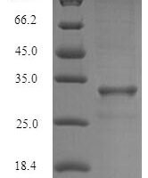 Blomia tropicalis Mite allergen Blo t 5 (BLOT5) Recombinant Protein - BioCrest Sci