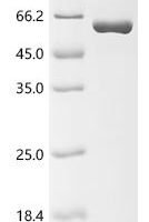 Escherichia coli Glycoside hydrolase family 1 Recombinant Protein - BioCrest Sci