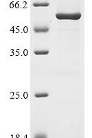 Escherichia coli Trimethylamine-N-oxide reductase 1 (torA), partial Recombinant Protein - BioCrest Sci