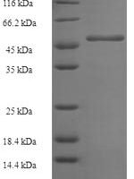 Human Geranylgeranyl pyrophosphate synthase (GGPS1) Recombinant Protein - BioCrest Sci