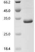 Human Bcl-2-modifying factor (BMF) Recombinant Protein, C-His - BioCrest Sci