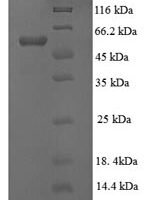 Human Lysyl oxidase homolog 1 (LOXL1), partial Recombinant Protein - BioCrest Sci