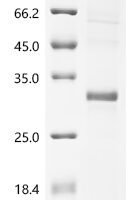 Human Ryanodine receptor 3 (RYR3), partial Recombinant Protein, N-10His - BioCrest Sci