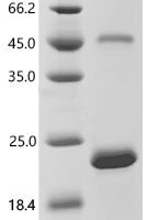 Human Apolipoprotein B-100 (APOB), partial Recombinant Protein, C-His - BioCrest Sci