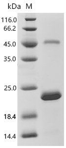 Human Apolipoprotein B-100 (APOB), partial Recombinant Protein, C-His, E.coli, C-terminal 6xHis-tagged, 18.1 kDa, purity >≥ 95% as determined by SDS-PAGE.
