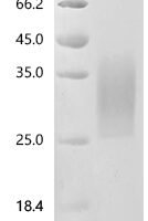 Mouse Triggering receptor expressed on myeloid cells 2 (Trem2), partial Recombinant Protein, C-10His - BioCrest Sci