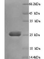 Human Butyrophilin subfamily 3 member A3 (BTN3A3), partial Recombinant Protein, N-His - BioCrest Sci