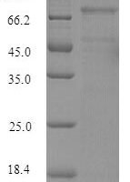 Mouse Lysyl oxidase homolog 4 (Loxl4) Recombinant Protein, N-His, aa 26–757, E.coli - BioCrest Sci