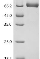 Human Interleukin-20 receptor subunit alpha (IL20RA), partial Recombinant Protein, C-hFc1 - BioCrest Sci