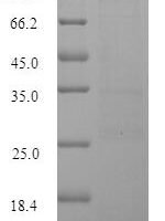 Ceratopteris richardii Cyanovirin-N homolog Recombinant Protein, Tag-Free - BioCrest Sci