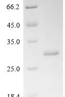 Human Eukaryotic translation initiation factor 5B (EIF5B), partial Recombinant Protein - BioCrest Sci