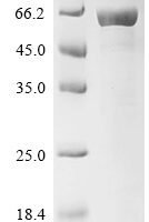 Pongo abelii Neurofilament light polypeptide (NEFL), partial Recombinant Protein - BioCrest Sci