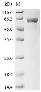 Pongo abelii Neurofilament light polypeptide (NEFL), partial Recombinant Protein, Pongo abelii (Sumatran orangutan) (Pongo pygmaeus abelii), in vitro E.coli expression system, N-terminal 6xHis-SUMO-tagged, 58.9 kDa, purity >≥ 85% as determined by SDS-PAGE.