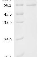 Human 3-phosphoinositide-dependent protein kinase 1 (PDPK1) Recombinant Protein, N-His - BioCrest Sci