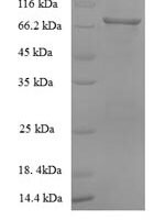 Macaca fascicularis albumin (ALB) Recombinant Protein, N-His - BioCrest Sci