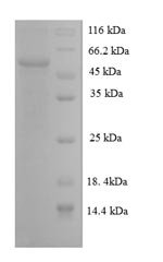 Rat Regucalcin (Rgn) Recombinant Protein, N-10His-SUMO, Rattus norvegicus (Rat), E.coli, N-terminal 10xHis-SUMO-tagged, 51.9 kDa, purity >≥ 85% as determined by SDS-PAGE.