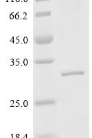 Human DnaJ homolog subfamily B member 6 (DNAJB6) Recombinant Protein, C-His, aa 2–241, Mammalian cell - BioCrest Sci