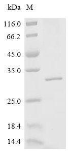 Human DnaJ homolog subfamily B member 6 (DNAJB6) Recombinant Protein, C-His, aa 2–241, Mammalian cell, Homo sapiens (Human), Mammalian cell, C-terminal 6xHis-tagged, 28.9 kDa, purity >≥ 85% as determined by SDS-PAGE.