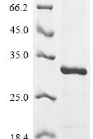 Human Interleukin-9 (IL9) Recombinant Protein, N-His-SUMO - BioCrest Sci