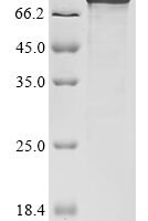 Human HHIP-like protein 1 (HHIPL1) Recombinant Protein - BioCrest Sci