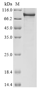 Human HHIP-like protein 1 (HHIPL1) Recombinant Protein, Homo sapiens (Human), E.coli, N-terminal 10xHis-tagged, 90.9 kDa, purity >≥ 85% as determined by SDS-PAGE.