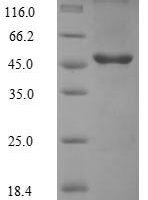 Human Transmembrane protein 25 (TMEM25) Recombinant Protein - BioCrest Sci