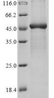 Human Caspase-4 (CASP4) Recombinant Protein - BioCrest Sci