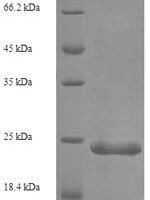 Human Complement C5 (C5), partial Recombinant Protein - BioCrest Sci