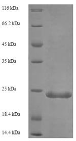 Human Complement C5 (C5), partial Recombinant Protein, Homo sapiens (Human), E.coli, N-terminal 6xHis-SUMO-tagged, 24.3 kDa, purity >≥ 90% as determined by SDS-PAGE.