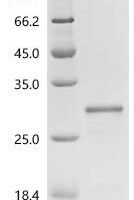 Mouse Uncharacterized protein C11orf86 homolog Recombinant Protein - BioCrest Sci