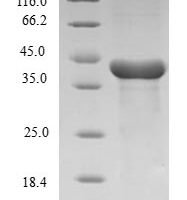Human Histone H3.1 (HIST1H3A) Recombinant Protein, N-GST - BioCrest Sci
