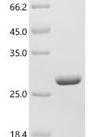 Glycine max Stress-induced protein SAM22 (PR-10) Recombinant Protein - BioCrest Sci