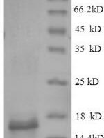 Gadus morhua subsp. callarias Parvalbumin beta Recombinant Protein - BioCrest Sci