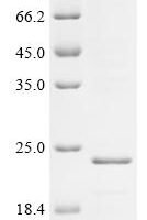 Bordetella pertussis Filamentous hemagglutinin (fhaB), partial Recombinant Protein, C-His, aa 1752–1879 - BioCrest Sci
