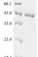 Mouse Glycerol-3-phosphate dehydrogenase [NAD(+)], cytoplasmic (Gpd1) Recombinant Protein - BioCrest Sci