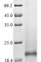 Human Solute carrier organic anion transporter family member 2B1 (SLCO2B1), partial Recombinant Protein - BioCrest Sci