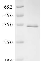 Sheep Fibroblast growth factor 2 (FGF2) Recombinant Protein, N-His-SUMO - BioCrest Sci